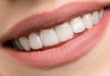 Teeth, smile, close-up. Calcivis